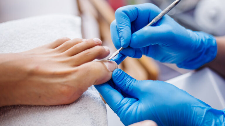 Stepping into Wellness: How Expert Podiatry Services in Miranda Enhance Your Foot Care Journey